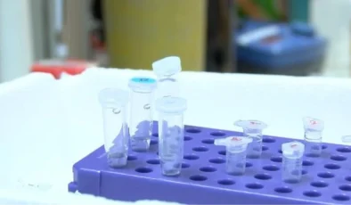 Ankara Üniversitesi Kök Hücre Enstitüsü, SMA Hastalığı için Kişiye Özel İlaç Test Kitini Geliştiriyor